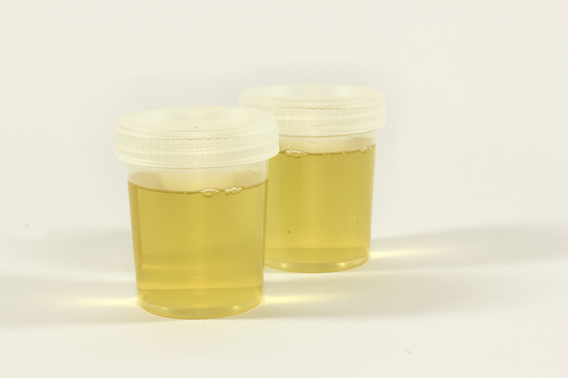 TDDA urine testing cups